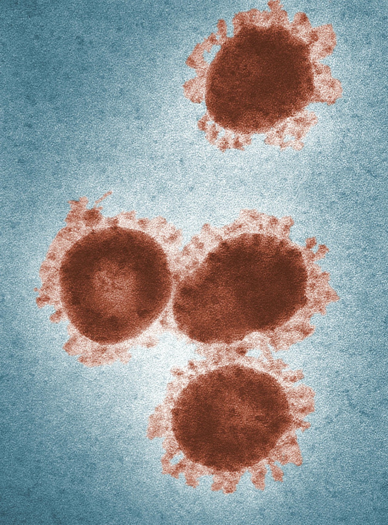 Obsense Infection IVIDENS for employers
